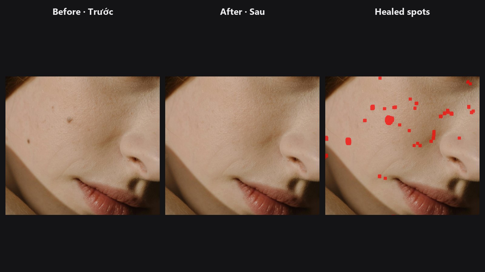 Auto Blemish — before, after, healed spots
