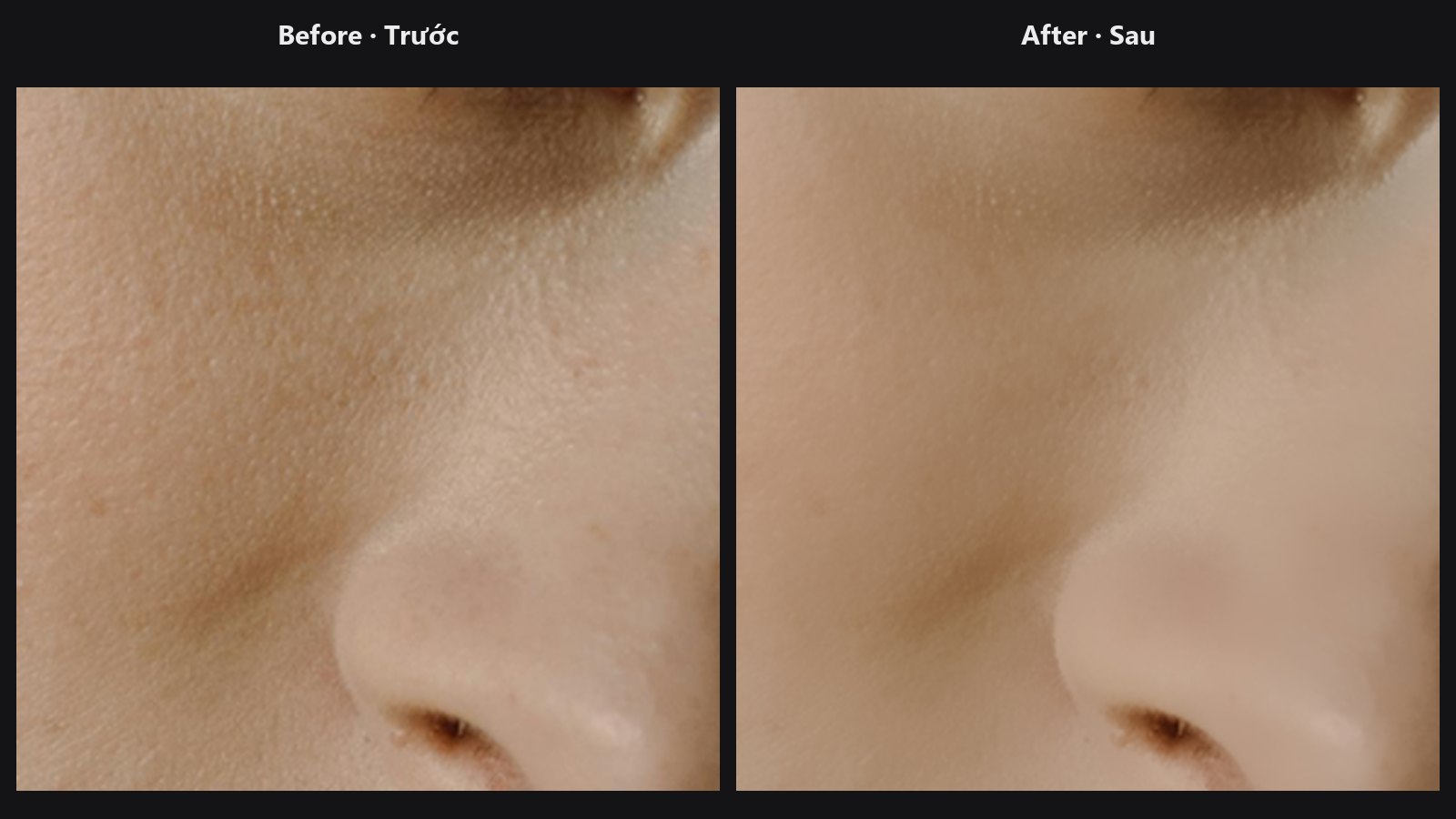 Skin Smoother — trước / sau