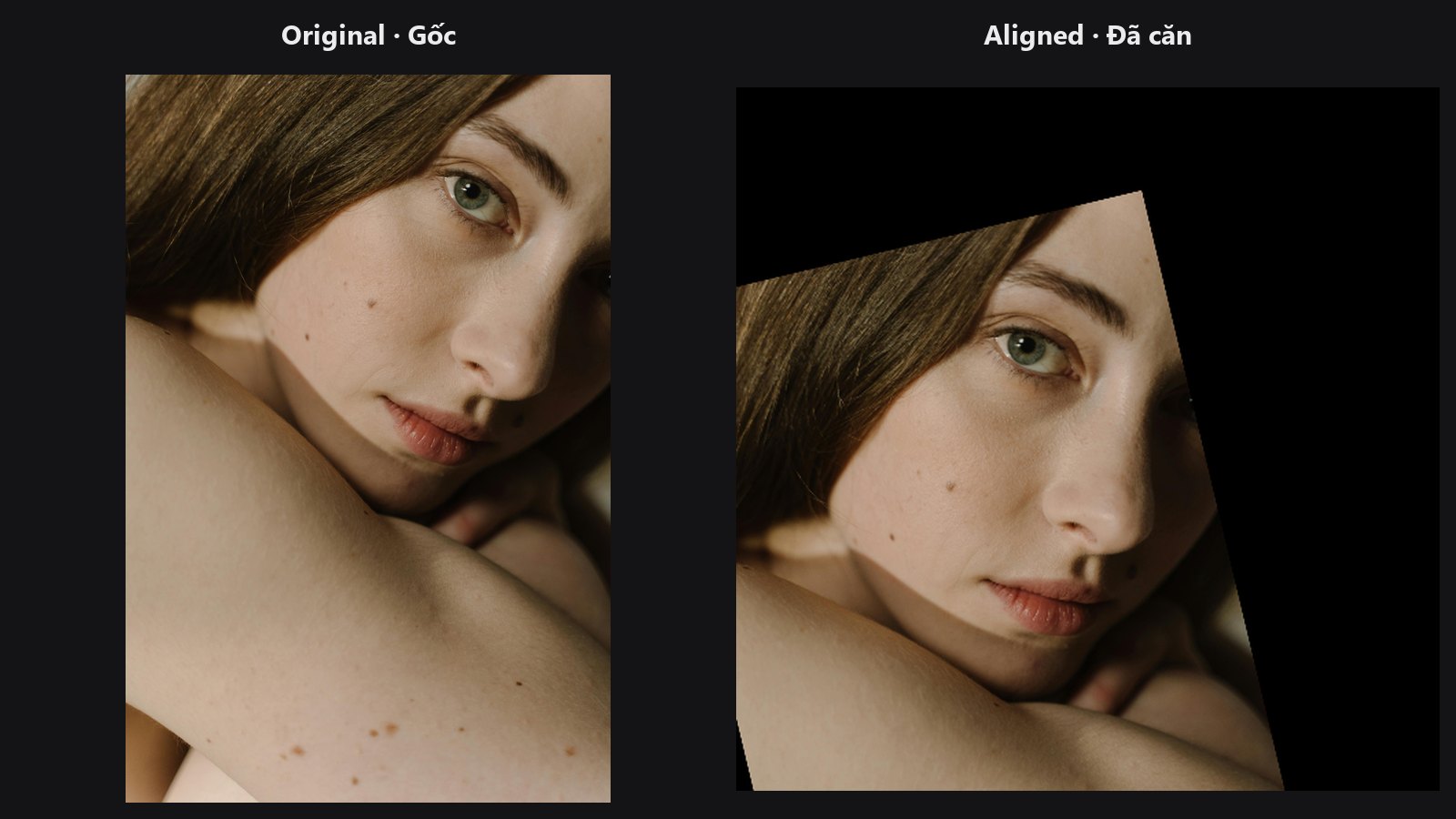 Facial Aligner — trước / sau